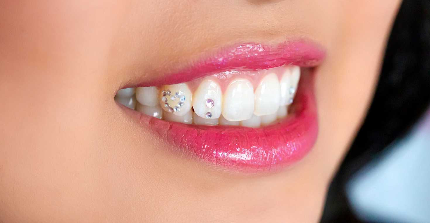 06 審美治療でより美しく